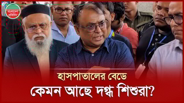 বিমানের আ গুনে দগ্ধ হয়েও বেঁচে থাকা শিশুদের অবস্থা এখন কেমন?