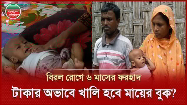 বিরল রোগে আক্রান্ত ছয় মাসের সন্তানকে বাঁচাতে মা-বাবার আকুতি