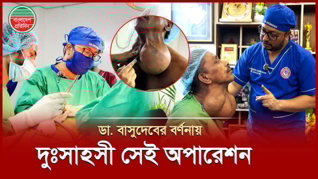 ৪৫ বছরের পুরনো টিউমারের সফল অপারেশন, কীভাবে সম্ভব হলো জানালেন ডা. বাসুদেব