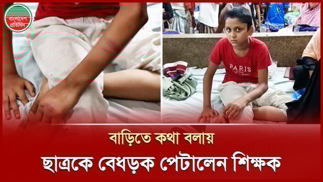 গাব গাছের ডাল দিয়ে বেধড়ক পেটালেন মাদ্রাসা শিক্ষক, হাসপাতালে ভর্তি শিক্ষার্থী