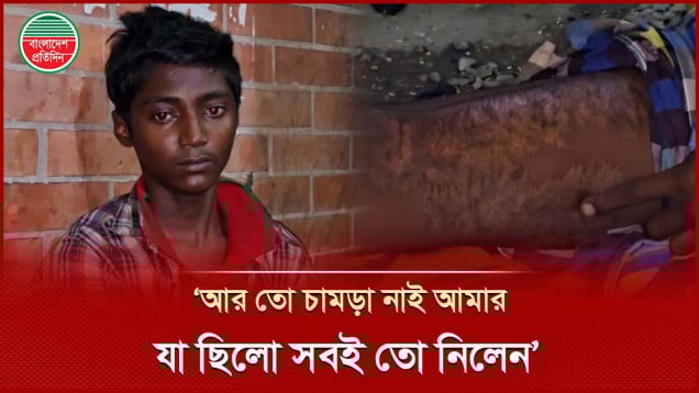 টাকা দিতে হবে তাই বাবা এখন পরিচয় দেন না, পা হারানো ইয়াসিনের আর্তনাদ