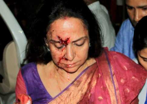 গ্রেফতার হলেন হেমা মালিনির গাড়ির চালক