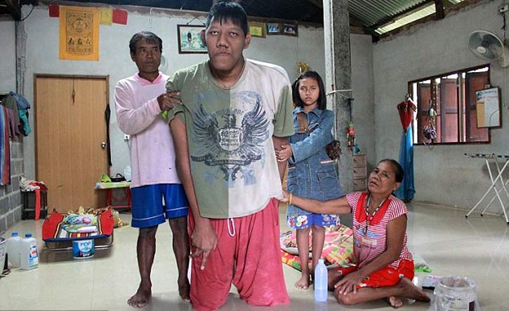বিশ্বের সবচেয়ে ‘লম্বা মানুষ’টি আর নেই 
