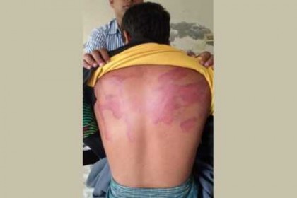 প্রেম করায় গরম ইস্ত্রির ছ্যাঁকা!