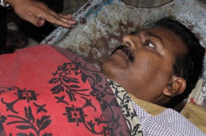 ফরিদপুরে হিন্দু-বৌদ্ধ-খ্রিস্টান ঐক্য পরিষদের নেতাকে কুপিয়ে জখম