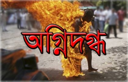পার্লারে সাজতে গিয়ে গৃহবধূ দগ্ধ 