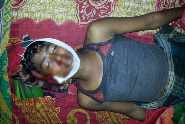 লামায় সুপারি পাড়তে গিয়ে যুবকের মৃত্যু 