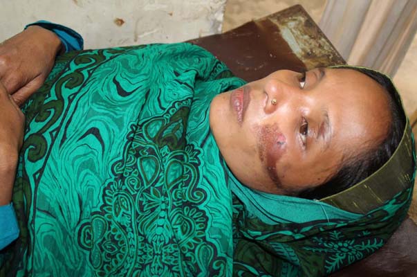 কুমিল্লায় হাত-পা বেঁধে গৃহবধূকে গরম খুন্তির ছ্যাঁকা!