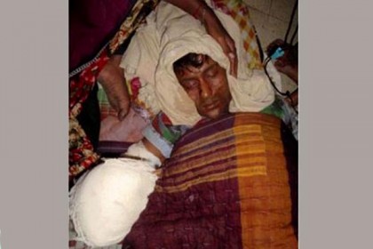 যশোরে বোমা তৈরিকালে উড়ে গেল কব্জি