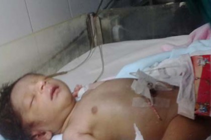 মারা গেছে সেই 'বেবি অব বিউটি'