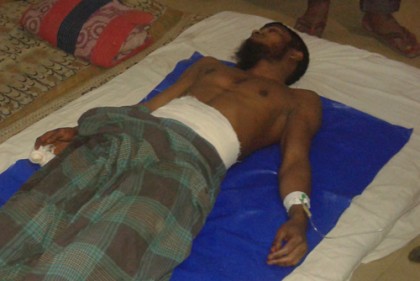 
ছিনতাইকারীর ছুরিকাঘাতে দর্শনার্থী আহত
