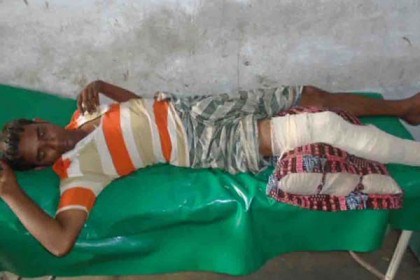 বাগেরহাটে নির্বাচনী সহিংসতায় আহত ৭