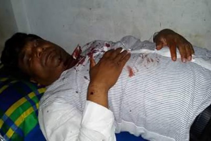 দু'দিনে ভাইস চেয়ারম্যান ও মেম্বার প্রার্থীসহ আহত ৭