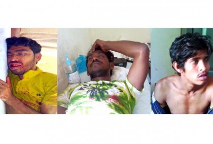 কলাপাড়ায় সড়ক দুর্ঘটনায় তিন পর্যটক গুরুতর জখম