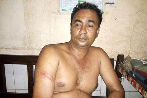 সন্ত্রাসীদের হামলার স্বীকার বাংলাদেশ প্রতিদিনের সাংবাদিক