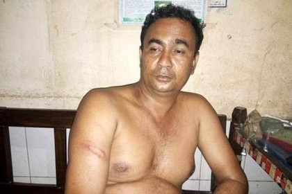 সন্ত্রাসীদের হামলার স্বীকার বাংলাদেশ প্রতিদিনের সাংবাদিক