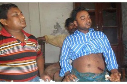 চুয়াডাঙ্গায় বোমা হামলায় আহত ৩