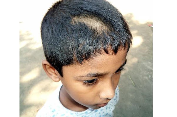২০ শিশুর এক গোছা করে চুল কেটে দিলেন শিক্ষক