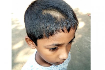 ২০ শিশুর এক গোছা করে চুল কেটে দিলেন শিক্ষক