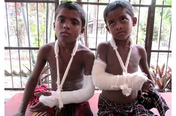 কলাপাড়ায় দুই সহোদরের হাত ভেঙ্গে দিলেন সৎ বাবা