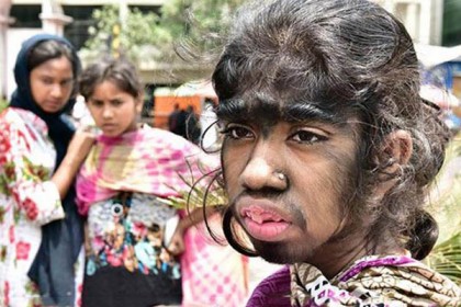 অদ্ভুত সমস্যায় স্কুলছাত্রী বীথি