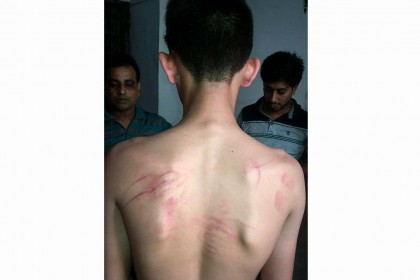 ছাত্র পিটিয়ে হাসপাতালে পাঠালেন শিক্ষক