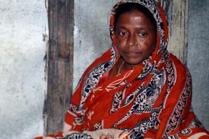 টিউমারের ওজন প্রায় ৫০ কেজি
