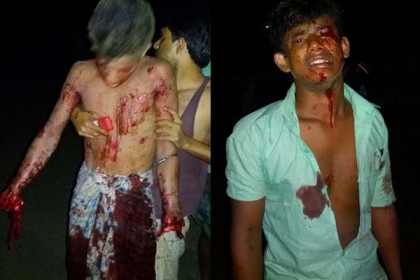 বোমা তৈরির সময় বিস্ফোরণে গুরুতর আহত ২