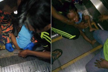 এস্কেলেটরে প্যান্ট আটকে পুরুষাঙ্গ হারালো শিশু