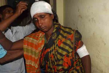 বাগানের তত্ত্বাবধায়ককে কুপিয়েছে ওয়ার্ড মেম্বার  