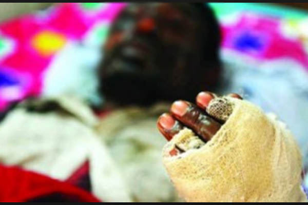 ঘুমন্ত স্বামীকে গরম তেলে ঝলসে দিল স্ত্রী