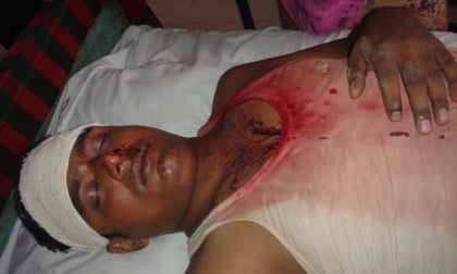 তাড়াশে মাছ ধরা নিয়ে দু’পক্ষের সংঘর্ষে আহত ১০