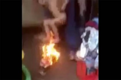 আগুনের ওপর ধরে শিশুকে শাস্তি বাবার!