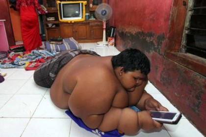 ১০ বছরের শিশুর ওজন ১৯২ কেজি!
