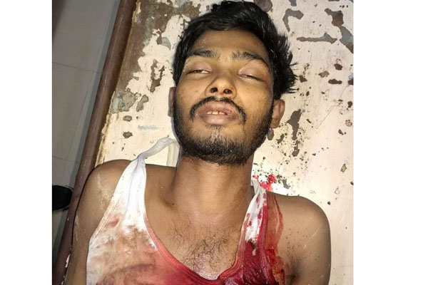 কক্সবাজারে সন্ত্রাসী ইসমাইলের গুলিবিদ্ধ লাশ উদ্ধার