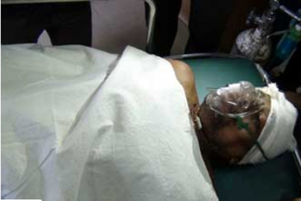 এবার সাতক্ষীরায় পুরোহিতকে কুপিয়ে হত্যার চেষ্টা