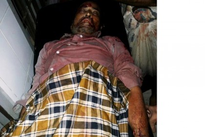 টেকনাফে সদর আওয়ামী লীগ সভাপতি খুন