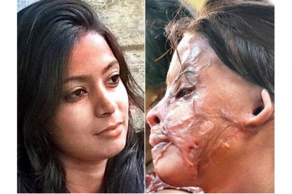 নিজের পোড়া চামড়া দেখে হাসছেন মনীষা