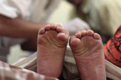 খতনার পর দুই কিশোরীর মৃত্যু