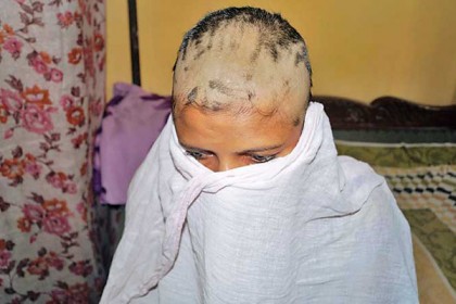 পরকীয়া সন্দেহে স্ত্রীকে ন্যাড়া করলেন স্বামী
