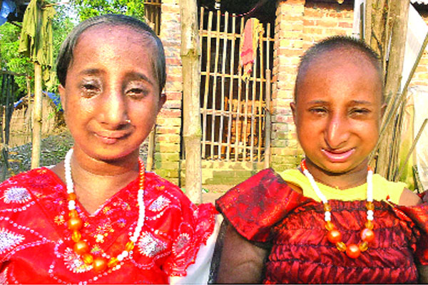পুতুলকন্যা রূপা ও মিমের বয়স বাড়ে উচ্চতা বাড়ে না