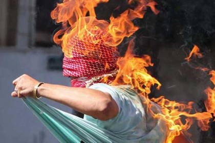 বোনকে বাঁচাতে গিয়ে অগ্নিদগ্ধ ভাই
