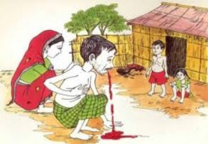
বছরে প্রতি লাখে ৪০৪ জন যক্ষ্মায় আক্রান্ত হয়
