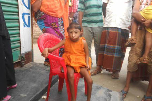 ‘অদ্ভুত শিশু’ মেরীর দিন কাটে ভিক্ষা করে 