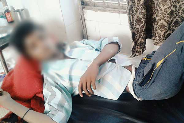মোবাইল ফোন চুরির অভিযোগে গোপনাঙ্গে পেট্রোল!