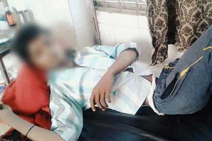 মোবাইল ফোন চুরির অভিযোগে গোপনাঙ্গে পেট্রোল!
