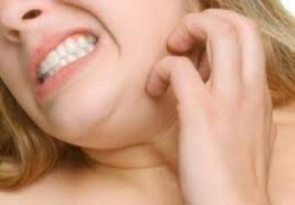 চর্মরোগ দূর করবেন যেভাবে