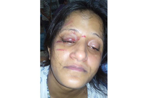 যৌতুক দাবিতে গৃহবধূকে নির্যাতন
