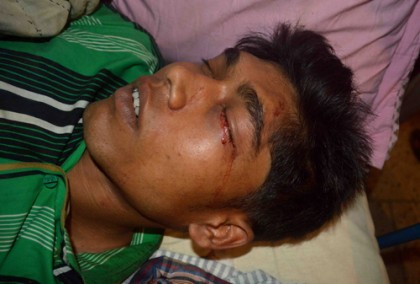 ১শ' টাকার জন্য মেরে রক্তাক্ত