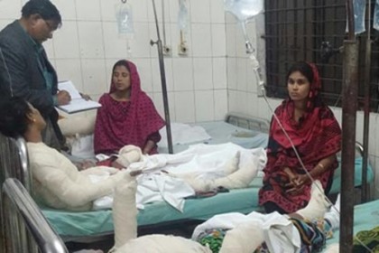'আশুলিয়ায় দগ্ধ ২১ শ্রমিকের অবস্থা আশঙ্কাজনক'